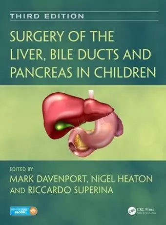 Surgery of the Liver, Bile Ducts and Pancreas in Children cover