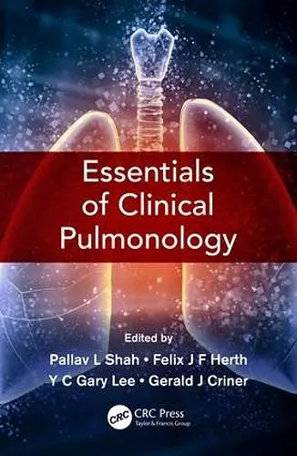 Essentials of Clinical Pulmonology cover