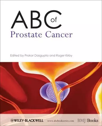 ABC of Prostate Cancer cover