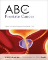 ABC of Prostate Cancer cover