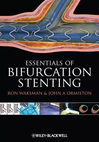 Bifurcation Stenting cover