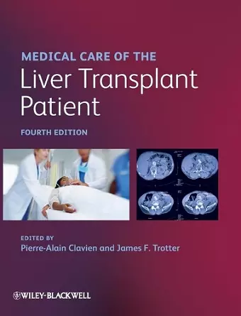 Medical Care of the Liver Transplant Patient cover