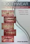 Toothwear cover