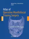 Atlas of Operative Maxillofacial Trauma Surgery cover