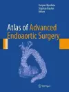 Atlas of Advanced Endoaortic Surgery cover