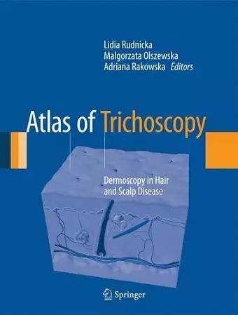 Atlas of Trichoscopy cover