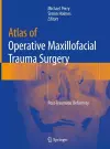 Atlas of Operative Maxillofacial Trauma Surgery cover