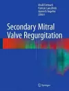 Secondary Mitral Valve Regurgitation cover