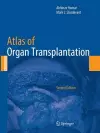 Atlas of Organ Transplantation cover