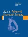 Atlas of Advanced Endoaortic Surgery cover