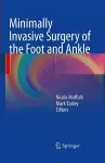 Minimally Invasive Surgery of the Foot and Ankle cover