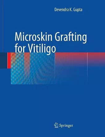 Microskin Grafting for Vitiligo cover