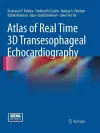 Atlas of Real Time 3D Transesophageal Echocardiography cover