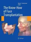 The Know-How of Face Transplantation cover