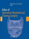 Atlas of Operative Maxillofacial Trauma Surgery cover