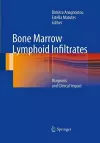 Bone Marrow Lymphoid Infiltrates cover