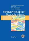 Noninvasive Imaging of Myocardial Ischemia cover