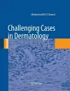 Challenging Cases in Dermatology cover