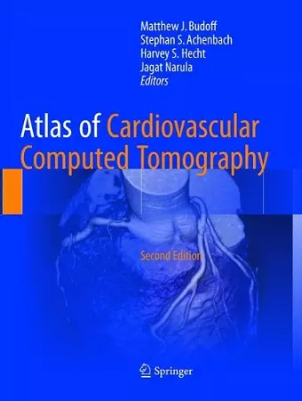 Atlas of Cardiovascular Computed Tomography cover