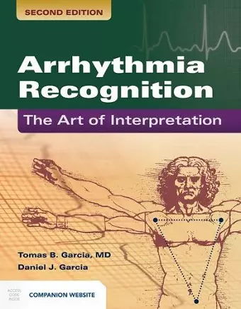 Arrhythmia Recognition: The Art Of Interpretation cover