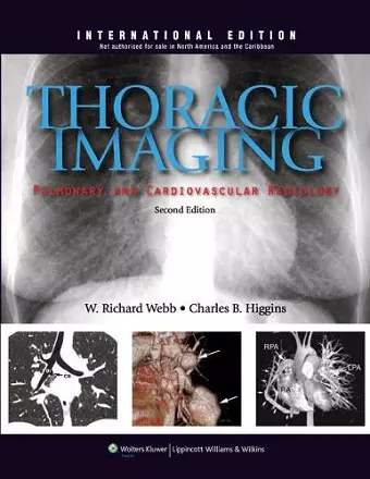 Thoracic Imaging cover