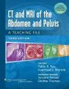 CT & MRI of the Abdomen and Pelvis cover