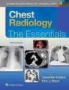 Chest Radiology: The Essentials cover
