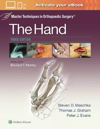 Master Techniques in Orthopaedic Surgery: The Hand cover