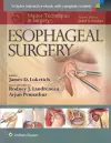 Master Techniques in Surgery: Esophageal Surgery cover