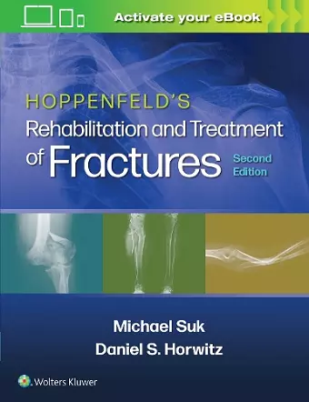 Hoppenfeld's Treatment and Rehabilitation of Fractures cover