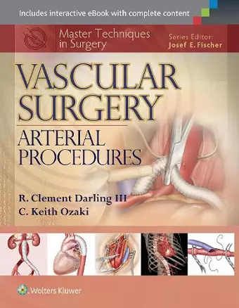 Master Techniques in Surgery: Vascular Surgery: Arterial Procedures cover