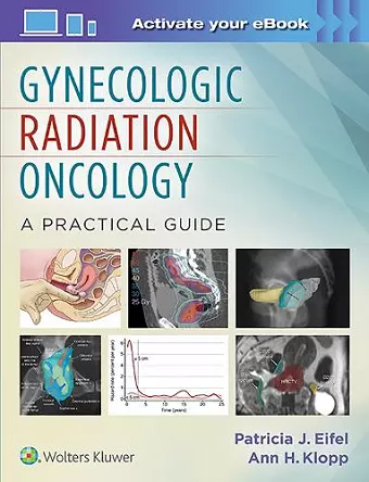 Gynecologic Radiation Oncology: A Practical Guide cover