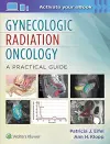 Gynecologic Radiation Oncology: A Practical Guide cover
