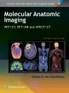 Molecular Anatomic Imaging cover