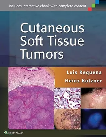 Cutaneous Soft Tissue Tumors cover