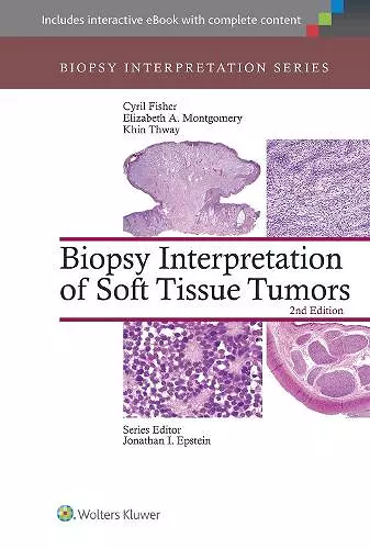 Biopsy Interpretation of Soft Tissue Tumors cover