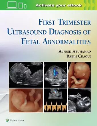 First Trimester Ultrasound Diagnosis of Fetal Abnormalities cover