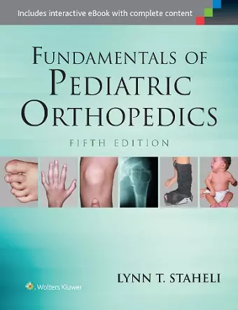 Fundamentals of Pediatric Orthopedics cover