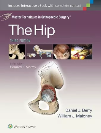 Master Techniques in Orthopaedic Surgery: The Hip cover