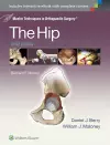 Master Techniques in Orthopaedic Surgery: The Hip cover