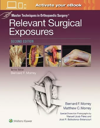 Master Techniques in Orthopaedic Surgery: Relevant Surgical Exposures cover