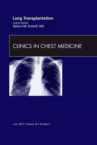 Lung Transplantation, An Issue of Clinics in Chest Medicine cover