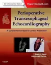 Perioperative Transesophageal Echocardiography cover