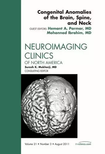 Congenital Anomalies of the Brain, Spine, and Neck, An Issue of Neuroimaging Clinics cover