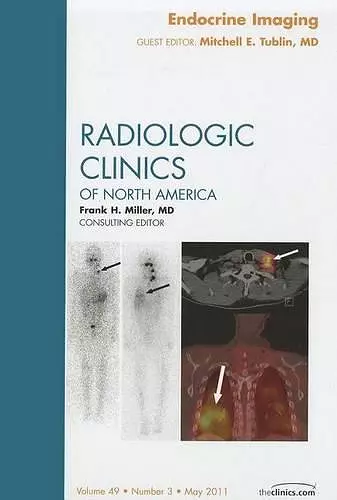 Endocrine Imaging, An Issue of Radiologic Clinics of North America cover