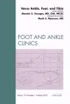 Varus Foot, Ankle, and Tibia, An Issue of Foot and Ankle Clinics cover