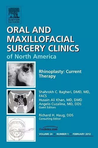 Rhinoplasty: Current Therapy, An Issue of Oral and Maxillofacial Surgery Clinics cover