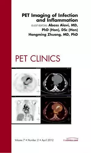 PET Imaging of Infection and Inflammation, An Issue of PET Clinics cover