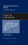 Nonalcoholic Fatty Liver Disease, An Issue of Clinics in Liver Disease cover