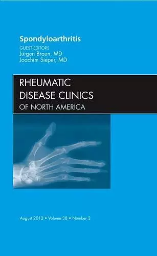 Spondyloarthropathies, An Issue of Rheumatic Disease Clinics cover